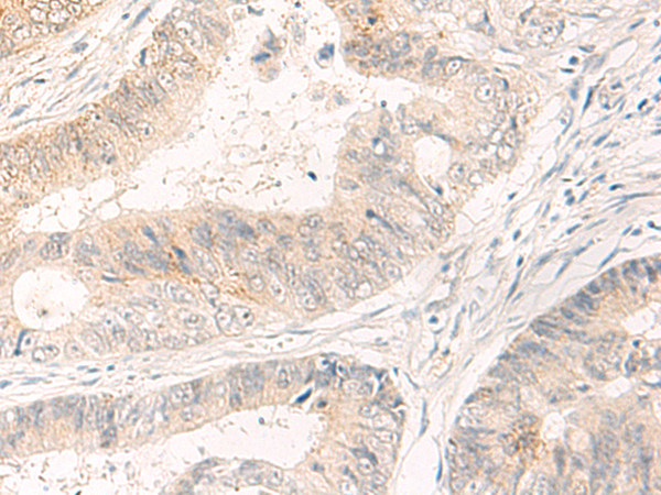 SYT16 Antibody