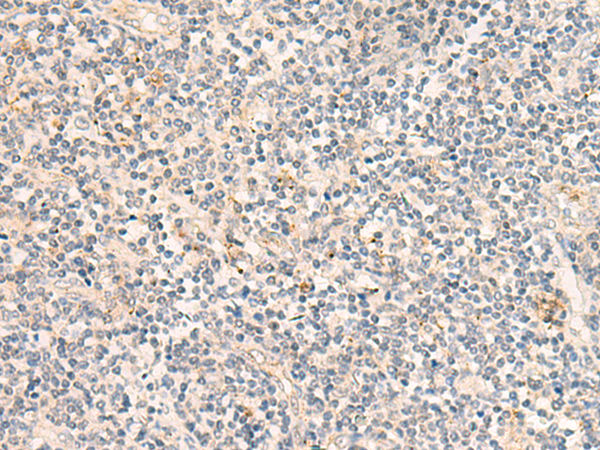 SYT16 Antibody