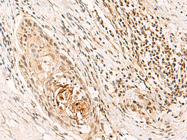 DPPA4 Antibody
