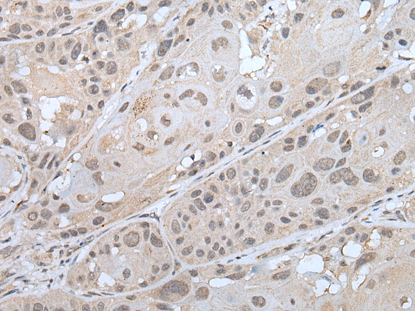 IRAK1 Antibody