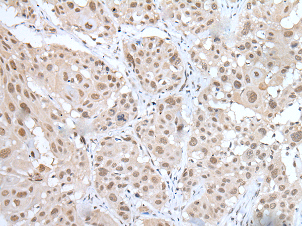MEF2A Antibody