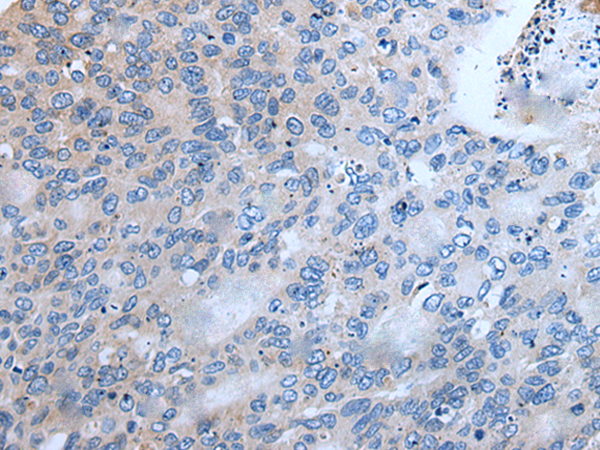 UPF3A Antibody