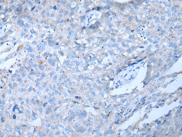 UPF3A Antibody