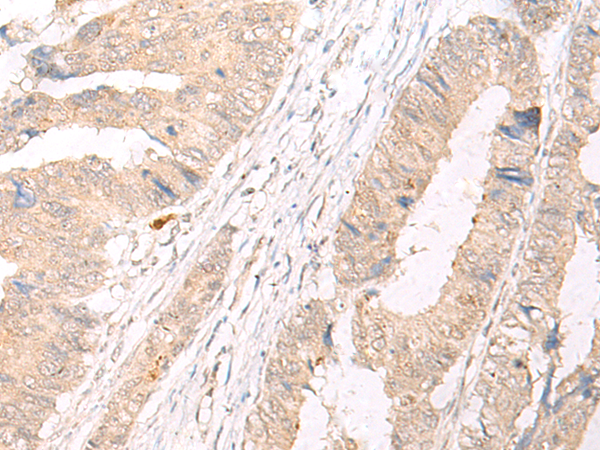 HLA-A/B/C Antibody