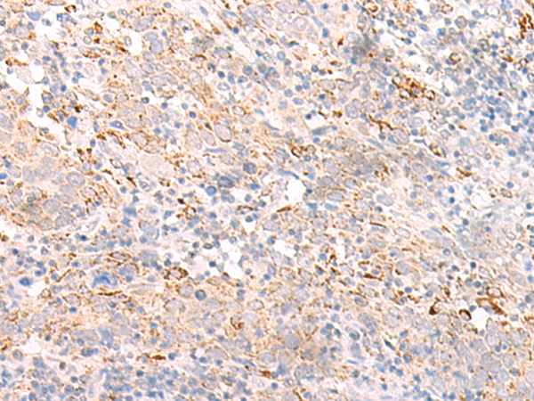 IFNL2 Antibody