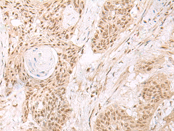 ESPN Antibody