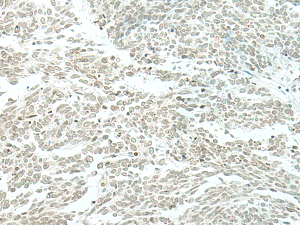 ESRP2 Antibody
