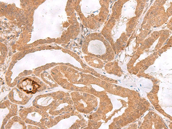 ETV3 Antibody