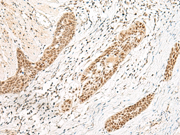 EVX1 Antibody