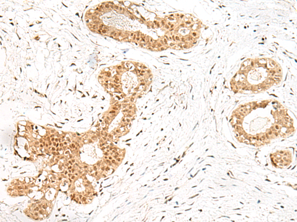 EVX1 Antibody