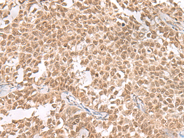 ZNF560 Antibody