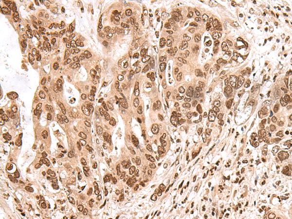 EXOSC9 Antibody