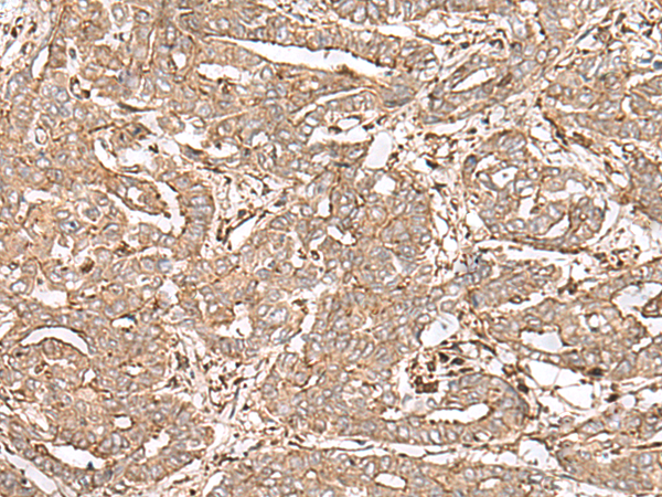 FAAP24 Antibody