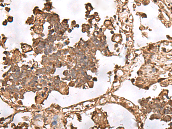 FAAP24 Antibody