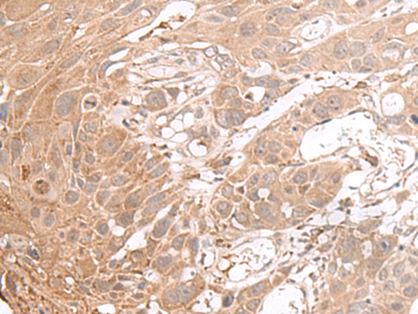 CHST4 Antibody