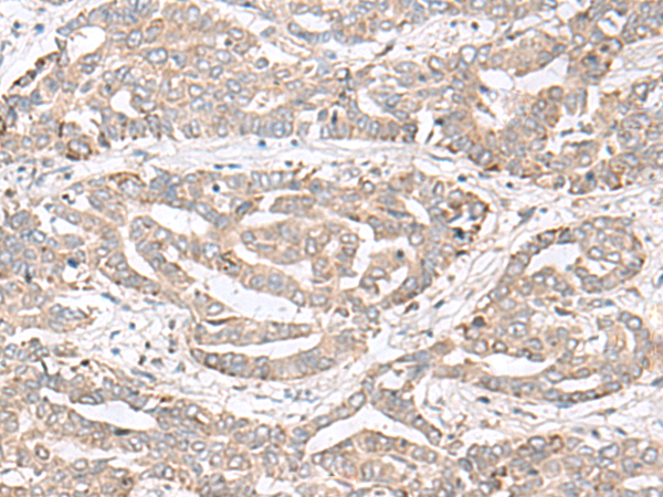 CHST4 Antibody