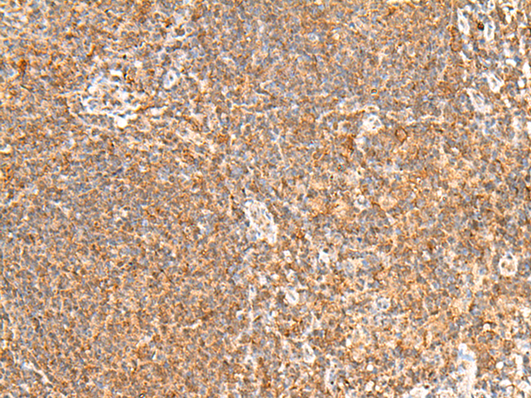 FAM177B Antibody