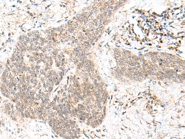 FAM84B Antibody