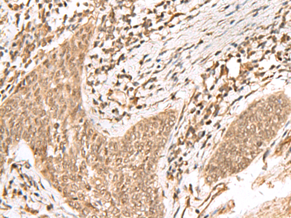 KDM2A Antibody