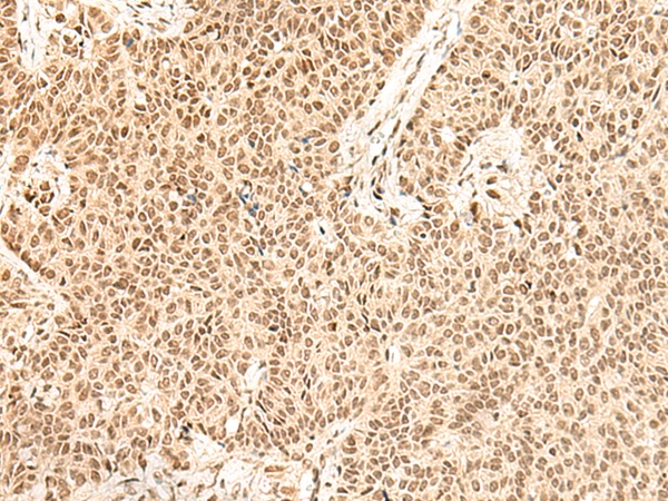 FBXL4 Antibody