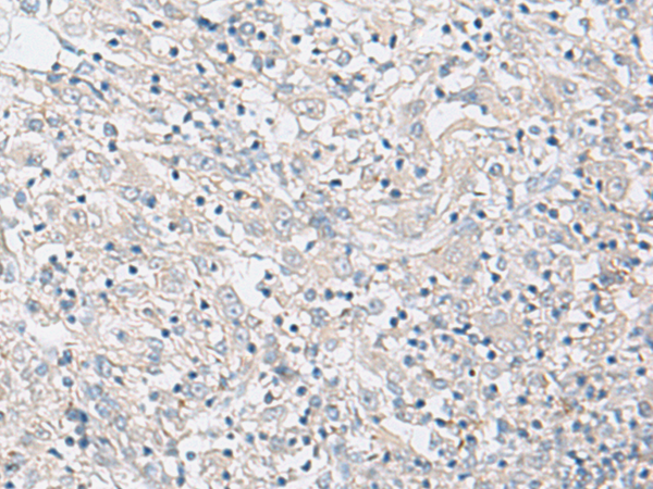 FBXO16 Antibody