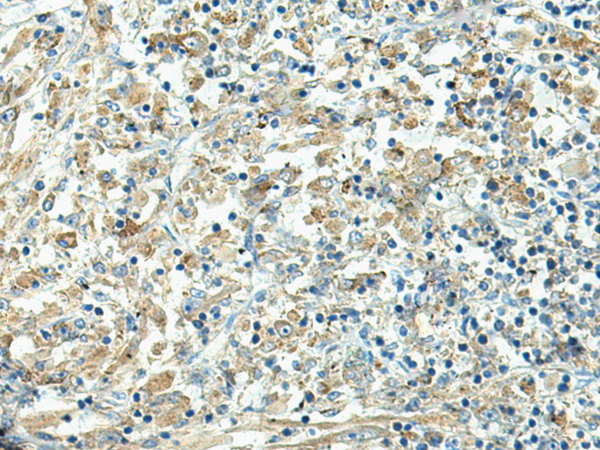 FCGRT Antibody