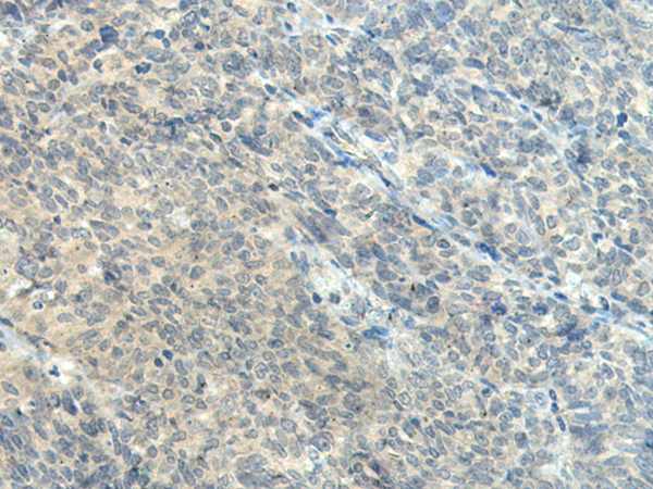 CTDP1 Antibody