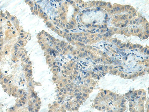 CTDP1 Antibody