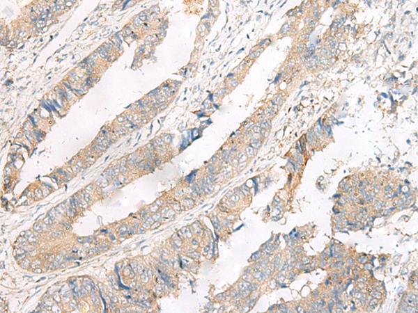 FERD3L Antibody