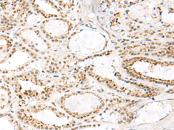 FKBP5 Antibody
