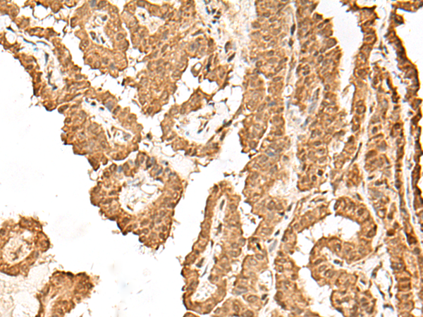 VPS50 Antibody
