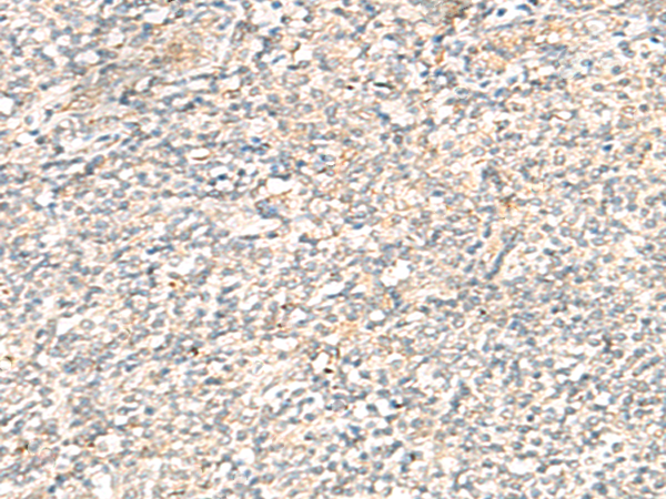 TACO1 Antibody