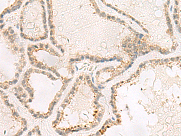 TACO1 Antibody