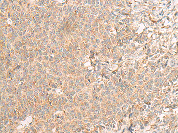 RNF207 Antibody