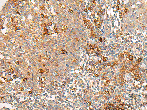 RNF207 Antibody