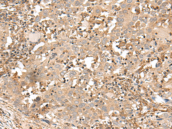 FSTL5 Antibody