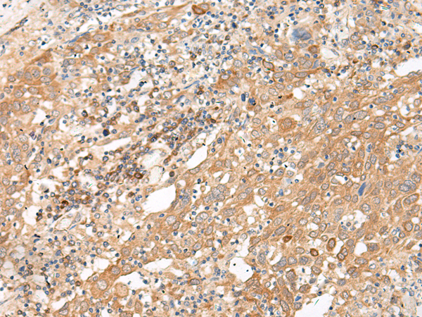 GALP Antibody