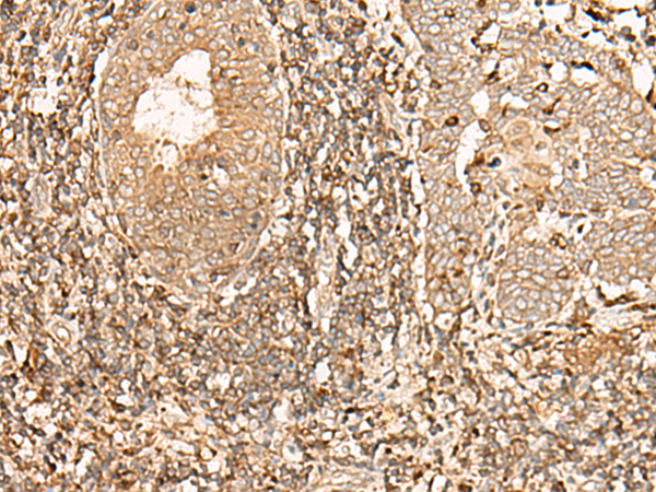 GALR2 Antibody