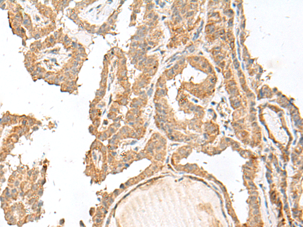 GART Antibody