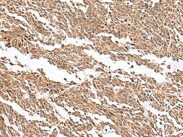 GBGT1 Antibody