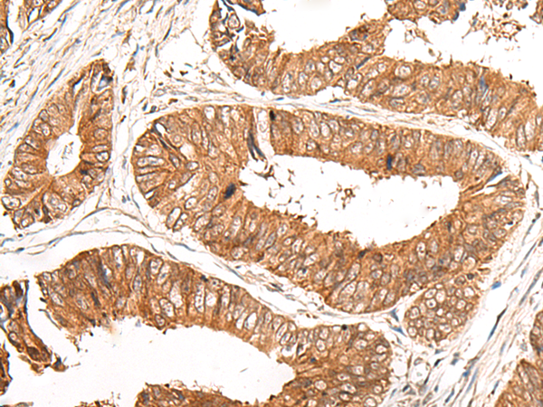 GFI1 Antibody