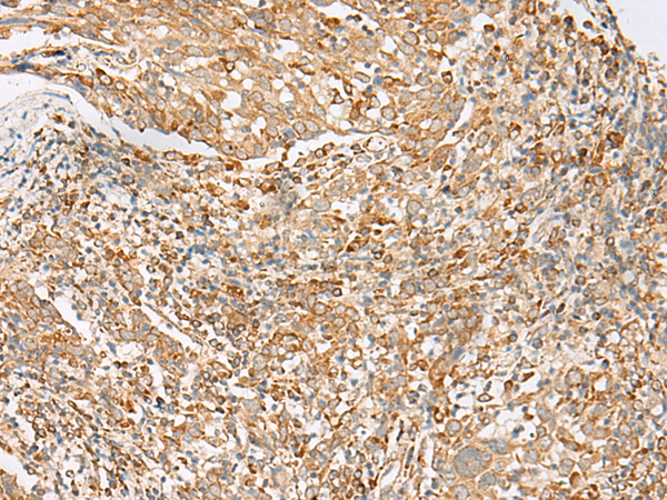MBOAT4 Antibody