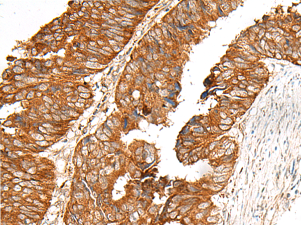MBOAT4 Antibody