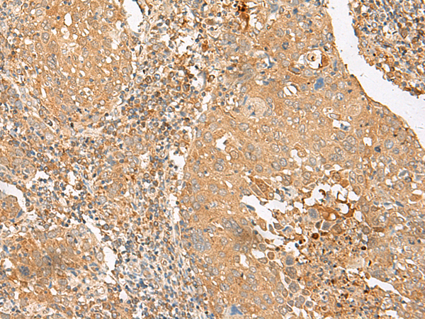 SLC2A8 Antibody