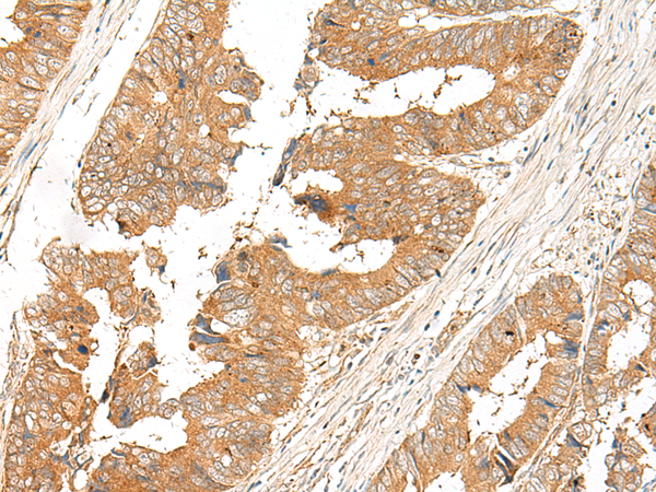 SLC2A8 Antibody