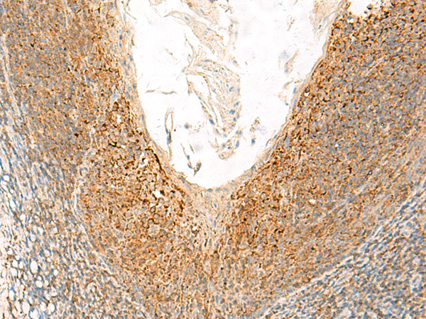 GLUD1 Antibody