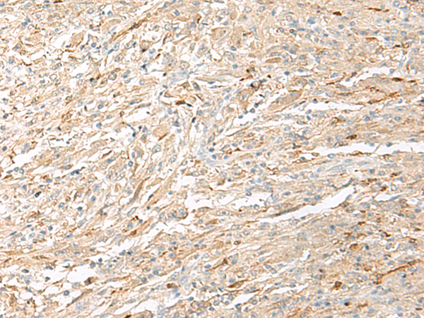 EPRS Antibody