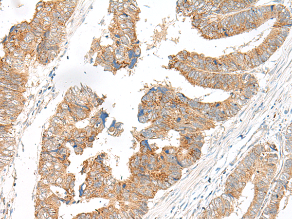 SLC6A9 Antibody