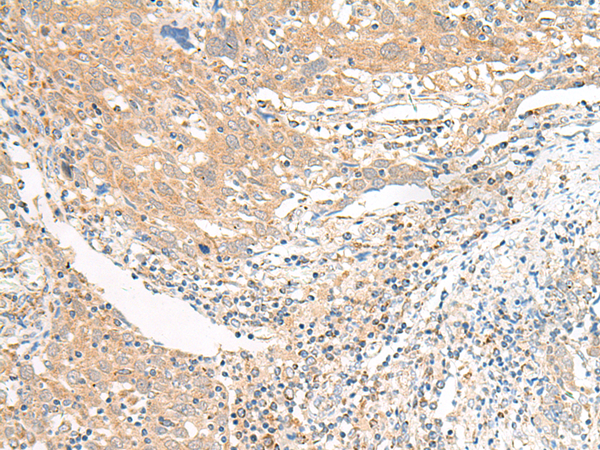 SLC6A9 Antibody
