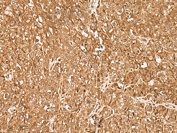 GMEB2 Antibody